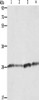 Gel: 10%SDS-PAGE, Lysate: 40 μg, Lane 1-4: Human placenta tissue, A549 cells, Raji cells, hela cells, Primary antibody: CSB-PA179766 (BCAP31 Antibody) at dilution 1/750, Secondary antibody: Goat anti rabbit IgG at 1/8000 dilution, Exposure time: 1 second
