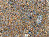 The image on the left is immunohistochemistry of paraffin-embedded Human cervical cancer tissue using CSB-PA842510 (BCAT2 Antibody) at dilution 1/70, on the right is treated with fusion protein. (Original magnification: ×200)