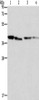 Gel: 12%SDS-PAGE, Lysate: 40 μg, Lane 1-4: Human placenta tissue, NIH/3T3 cells, Raji cells, hepG2 cells, Primary antibody: CSB-PA842510 (BCAT2 Antibody) at dilution 1/312.5, Secondary antibody: Goat anti rabbit IgG at 1/8000 dilution, Exposure time: 5 seconds