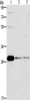 Gel: 10%SDS-PAGE, Lysate: 40 μg, Lane 1-3: HepG2 cells, Raji cells, 293T cells, Primary antibody: CSB-PA390581 (BCL10 Antibody) at dilution 1/950, Secondary antibody: Goat anti rabbit IgG at 1/8000 dilution, Exposure time: 40 seconds