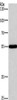 Gel: 8%SDS-PAGE, Lysate: 40 μg, Lane: Raji cells, Primary antibody: CSB-PA926374 (BLK Antibody) at dilution 1/250, Secondary antibody: Goat anti rabbit IgG at 1/8000 dilution, Exposure time: 20 seconds