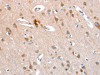 The image on the left is immunohistochemistry of paraffin-embedded Human brain tissue using CSB-PA438854 (KEL Antibody) at dilution 1/40, on the right is treated with fusion protein. (Original magnification: ×200)