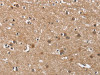 The image on the left is immunohistochemistry of paraffin-embedded Human brain tissue using CSB-PA941013 (BUB1 Antibody) at dilution 1/60, on the right is treated with fusion protein. (Original magnification: ×200)