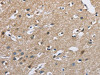 The image on the left is immunohistochemistry of paraffin-embedded Human brain tissue using CSB-PA796667 (CAB39L Antibody) at dilution 1/40, on the right is treated with fusion protein. (Original magnification: ×200)