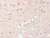 The image on the left is immunohistochemistry of paraffin-embedded Human brain tissue using CSB-PA049918 (LY96 Antibody) at dilution 1/20, on the right is treated with fusion protein. (Original magnification: ×200)