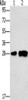 Gel: 10%SDS-PAGE, Lysate: 40 μg, Lane 1-2: Mouse liver tissue, 231 cells, Primary antibody: CSB-PA049918 (LY96 Antibody) at dilution 1/500, Secondary antibody: Goat anti rabbit IgG at 1/8000 dilution, Exposure time: 1 minute