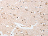 The image on the left is immunohistochemistry of paraffin-embedded Human brain tissue using CSB-PA644111 (CDKN2C Antibody) at dilution 1/25, on the right is treated with fusion protein. (Original magnification: ×200)