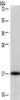 Gel: 6%SDS-PAGE, Lysate: 40 μg, Lane: Raji cells, Primary antibody: CSB-PA644111 (CDKN2C Antibody) at dilution 1/325, Secondary antibody: Goat anti rabbit IgG at 1/8000 dilution, Exposure time: 40 seconds