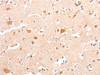 The image on the left is immunohistochemistry of paraffin-embedded Human brain tissue using CSB-PA087998 (CIDEC Antibody) at dilution 1/30, on the right is treated with fusion protein. (Original magnification: ×200)