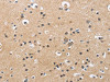 The image is immunohistochemistry of paraffin-embedded Human brain tissue using CSB-PA698913 (CKMT2 Antibody) at dilution 1/60. (Original magnification: ×200)