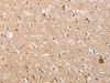 The image on the left is immunohistochemistry of paraffin-embedded Human brain tissue using CSB-PA966173 (CTAGE5 Antibody) at dilution 1/40, on the right is treated with fusion protein. (Original magnification: ×200)