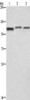 Gel: 10%SDS-PAGE, Lysate: 40 μg, Lane 1-3: PC3 cells, human brain malignant glioma tissue, A172 cells, Primary antibody: CSB-PA966173 (CTAGE5 Antibody) at dilution 1/200, Secondary antibody: Goat anti rabbit IgG at 1/8000 dilution, Exposure time: 1 second