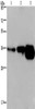 Gel: 8%SDS-PAGE, Lysate: 40 μg, Lane 1-3: Human breast infiltrative duct tissue, Human fetal brain tissue, mouse brain tissue, Primary antibody: CSB-PA283839 (CUEDC2 Antibody) at dilution 1/600, Secondary antibody: Goat anti rabbit IgG at 1/8000 dilution, Exposure time: 2 minutes