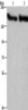 Gel: 6%SDS-PAGE, Lysate: 40 μg, Lane 1-2: Mouse brain tissue, human fetal brain tissue, Primary antibody: CSB-PA122670 (CYFIP2 Antibody) at dilution 1/300, Secondary antibody: Goat anti rabbit IgG at 1/8000 dilution, Exposure time: 2 minutes