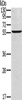 Gel: 8%SDS-PAGE, Lysate: 40 μg, Lane: Human breast infiltrative duct tissue, Primary antibody: CSB-PA891037 (CYP21A2 Antibody) at dilution 1/350, Secondary antibody: Goat anti rabbit IgG at 1/8000 dilution, Exposure time: 2 minutes