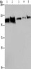 Gel: 6%SDS-PAGE, Lysate: 40 μg, Lane 1-5: Hela cells, Raji cells, NIH/3T3 cells, HepG2 cells, A375 cells, Primary antibody: CSB-PA823938 (HSPA4 Antibody) at dilution 1/300, Secondary antibody: Goat anti rabbit IgG at 1/8000 dilution, Exposure time: 40 seconds