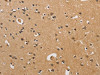 The image on the left is immunohistochemistry of paraffin-embedded Human brain tissue using CSB-PA954269 (CST6 Antibody) at dilution 1/70, on the right is treated with fusion protein. (Original magnification: ×200)