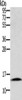 Gel: 12%SDS-PAGE, Lysate: 40 μg, Lane: Human liver cancer tissue, Primary antibody: CSB-PA063818 (CST2 Antibody) at dilution 1/250, Secondary antibody: Goat anti rabbit IgG at 1/8000 dilution, Exposure time: 5 minutes