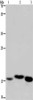 Gel: 10%SDS-PAGE, Lysate: 40 μg, Lane 1-3: Mouse kidney tissue, human fetal liver tissue, mouse liver tissue, Primary antibody: CSB-PA870342 (CYB5A Antibody) at dilution 1/250, Secondary antibody: Goat anti rabbit IgG at 1/8000 dilution, Exposure time: 1 minute