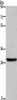 Gel: 10%SDS-PAGE, Lysate: 40 μg, Lane: A375 cells, Primary antibody: CSB-PA099615 (DHRS3 Antibody) at dilution 1/600, Secondary antibody: Goat anti rabbit IgG at 1/8000 dilution, Exposure time: 20 seconds