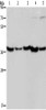 Gel: 8%SDS-PAGE, Lysate: 40 μg, Lane 1-5: Human fetal liver tissue, mouse skeletal muscle tissue, Mouse heart tissue, Hela cells, Jurkat cells, Primary antibody: CSB-PA727123 (DNAJB4 Antibody) at dilution 1/200, Secondary antibody: Goat anti rabbit IgG at 1/8000 dilution, Exposure time: 15 seconds