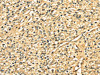 The image on the left is immunohistochemistry of paraffin-embedded Human prostate cancer tissue using CSB-PA065296 (DNASE1 Antibody) at dilution 1/25, on the right is treated with fusion protein. (Original magnification: ×200)