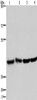 Gel: 6%SDS-PAGE, Lysate: 40 μg, Lane 1-4: Human fetal liver tissue, Human brain tissue, 293T cells, Hela cells, Primary antibody: CSB-PA696333 (DRG1 Antibody) at dilution 1/350, Secondary antibody: Goat anti rabbit IgG at 1/8000 dilution, Exposure time: 20 seconds