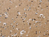 The image on the left is immunohistochemistry of paraffin-embedded Human brain tissue using CSB-PA929092 (DUSP23 Antibody) at dilution 1/20, on the right is treated with fusion protein. (Original magnification: ×200)
