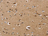 The image on the left is immunohistochemistry of paraffin-embedded Human brain tissue using CSB-PA142614 (UBE2S Antibody) at dilution 1/40, on the right is treated with fusion protein. (Original magnification: ×200)