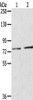 Gel: 6%SDS-PAGE, Lysate: 40 μg, Lane 1-2: A172 cells, Mouse liver tissue, Primary antibody: CSB-PA570366 (ECE2 Antibody) at dilution 1/350 dilution, Secondary antibody: Goat anti rabbit IgG at 1/8000 dilution, Exposure time: 20 seconds