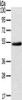 Gel: 8%SDS-PAGE, Lysate: 40 μg, Lane: Human kidney cancer tissue, Primary antibody: CSB-PA931107 (EDIL3 Antibody) at dilution 1/250, Secondary antibody: Goat anti rabbit IgG at 1/8000 dilution, Exposure time: 2 minutes