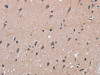The image on the left is immunohistochemistry of paraffin-embedded Human brain tissue using CSB-PA965968 (KIAA1324 Antibody) at dilution 1/40, on the right is treated with fusion protein. (Original magnification: ×200)