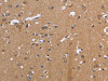 The image on the left is immunohistochemistry of paraffin-embedded Human brain tissue using CSB-PA064264 (KIAA1324 Antibody) at dilution 1/30, on the right is treated with fusion protein. (Original magnification: ×200)