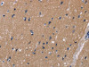 The image on the left is immunohistochemistry of paraffin-embedded Human brain tissue using CSB-PA746124 (KCNJ11 Antibody) at dilution 1/40, on the right is treated with fusion protein. (Original magnification: ×200)