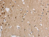 The image on the left is immunohistochemistry of paraffin-embedded Human brain tissue using CSB-PA934646 (ELOVL1 Antibody) at dilution 1/30, on the right is treated with fusion protein. (Original magnification: ×200)