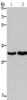 Gel: 10%SDS-PAGE, Lysate: 40 μg, Lane 1-2: Hela cells, A375 cells, Primary antibody: CSB-PA939360 (ELOVL1 Antibody) at dilution 1/550, Secondary antibody: Goat anti rabbit IgG at 1/8000 dilution, Exposure time: 20 seconds