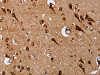 The image on the left is immunohistochemistry of paraffin-embedded Human brain tissue using CSB-PA283664 (EPDR1 Antibody) at dilution 1/20, on the right is treated with fusion protein. (Original magnification: ×200)
