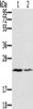 Gel: 12%SDS-PAGE, Lysate: 40 μg, Lane 1-2: Human normal right lung tissue, Human normal left lung tissue, Primary antibody: CSB-PA161267 (EDN2 Antibody) at dilution 1/600, Secondary antibody: Goat anti rabbit IgG at 1/8000 dilution, Exposure time: 2 minutes
