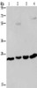 Gel: 10%SDS-PAGE, Lysate: 40 μg, Lane 1-4: A549 cells, human hepatocellular carcinoma tissue, mouse liver tissue, HT29 cells, Primary antibody: CSB-PA703411 (ETHE1 Antibody) at dilution 1/400, Secondary antibody: Goat anti rabbit IgG at 1/8000 dilution, Exposure time: 1 minute