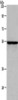 Gel: 8%SDS-PAGE, Lysate: 40 μg, Lane: MCF7 cells, Primary antibody: CSB-PA695360 (ETS2 Antibody) at dilution 1/300, Secondary antibody: Goat anti rabbit IgG at 1/8000 dilution, Exposure time: 1 minute Gel: 8%SDS-PAGE, Lysate: 40 μg, Lane: MCF7 cells, Primary antibody: CSB-PA695360 (ETS2 Antibody) at dilution 1/300, Secondary antibody: Goat anti rabbit IgG at 1/8000 dilution, Exposure time: 1 minute