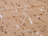 The image on the left is immunohistochemistry of paraffin-embedded Human brain tissue using CSB-PA139252 (FAAH2 Antibody) at dilution 1/30, on the right is treated with fusion protein. (Original magnification: ×200)