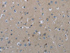 The image on the left is immunohistochemistry of paraffin-embedded Human brain tissue using CSB-PA277783 (FAAH Antibody) at dilution 1/50, on the right is treated with fusion protein. (Original magnification: ×200)