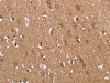 The image on the left is immunohistochemistry of paraffin-embedded Human brain tissue using CSB-PA170264 (FABP6 Antibody) at dilution 1/30, on the right is treated with fusion protein. (Original magnification: ×200)