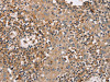 The image on the left is immunohistochemistry of paraffin-embedded Human tonsil tissue using CSB-PA286186 (FAIM2 Antibody) at dilution 1/40, on the right is treated with fusion protein. (Original magnification: ×200)