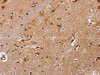 The image on the left is immunohistochemistry of paraffin-embedded Human brain tissue using CSB-PA089265 (FBP2 Antibody) at dilution 1/40, on the right is treated with fusion protein. (Original magnification: ×200)