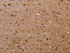 The image on the left is immunohistochemistry of paraffin-embedded Human brain tissue using CSB-PA103410 (FBP2 Antibody) at dilution 1/40, on the right is treated with fusion protein. (Original magnification: ×200)