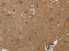 The image on the left is immunohistochemistry of paraffin-embedded Human brain tissue using CSB-PA290047 (FGF21 Antibody) at dilution 1/20, on the right is treated with fusion protein. (Original magnification: ×200)