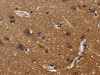 The image on the left is immunohistochemistry of paraffin-embedded Human brain tissue using CSB-PA448974 (FGFR1OP Antibody) at dilution 1/40, on the right is treated with fusion protein. (Original magnification: ×200)