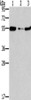 Gel: 8%SDS-PAGE, Lysate: 40 μg, Lane 1-3: Mouse heart tissue, NIH/3T3 cells, mouse liver tissue, Primary antibody: CSB-PA448974 (FGFR1OP Antibody) at dilution 1/850, Secondary antibody: Goat anti rabbit IgG at 1/8000 dilution, Exposure time: 2 minutes