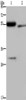 Gel: 8%SDS-PAGE, Lysate: 40 μg, Lane 1-2: Human placenta tissue, Human fetal intestine tissue, Primary antibody: CSB-PA175167 (FGL2 Antibody) at dilution 1/450, Secondary antibody: Goat anti rabbit IgG at 1/8000 dilution, Exposure time: 2 minutes